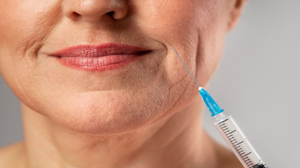 What Are The Typical Areas Treated With Mesotherapy?