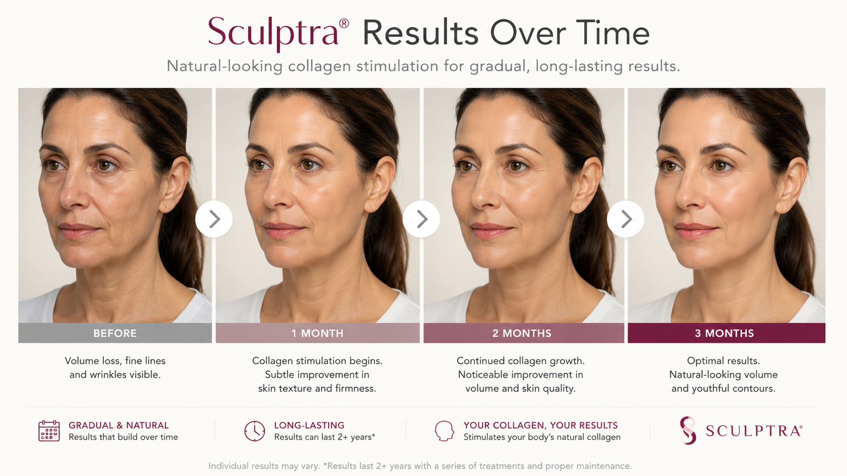 natural looking results Sculptra
