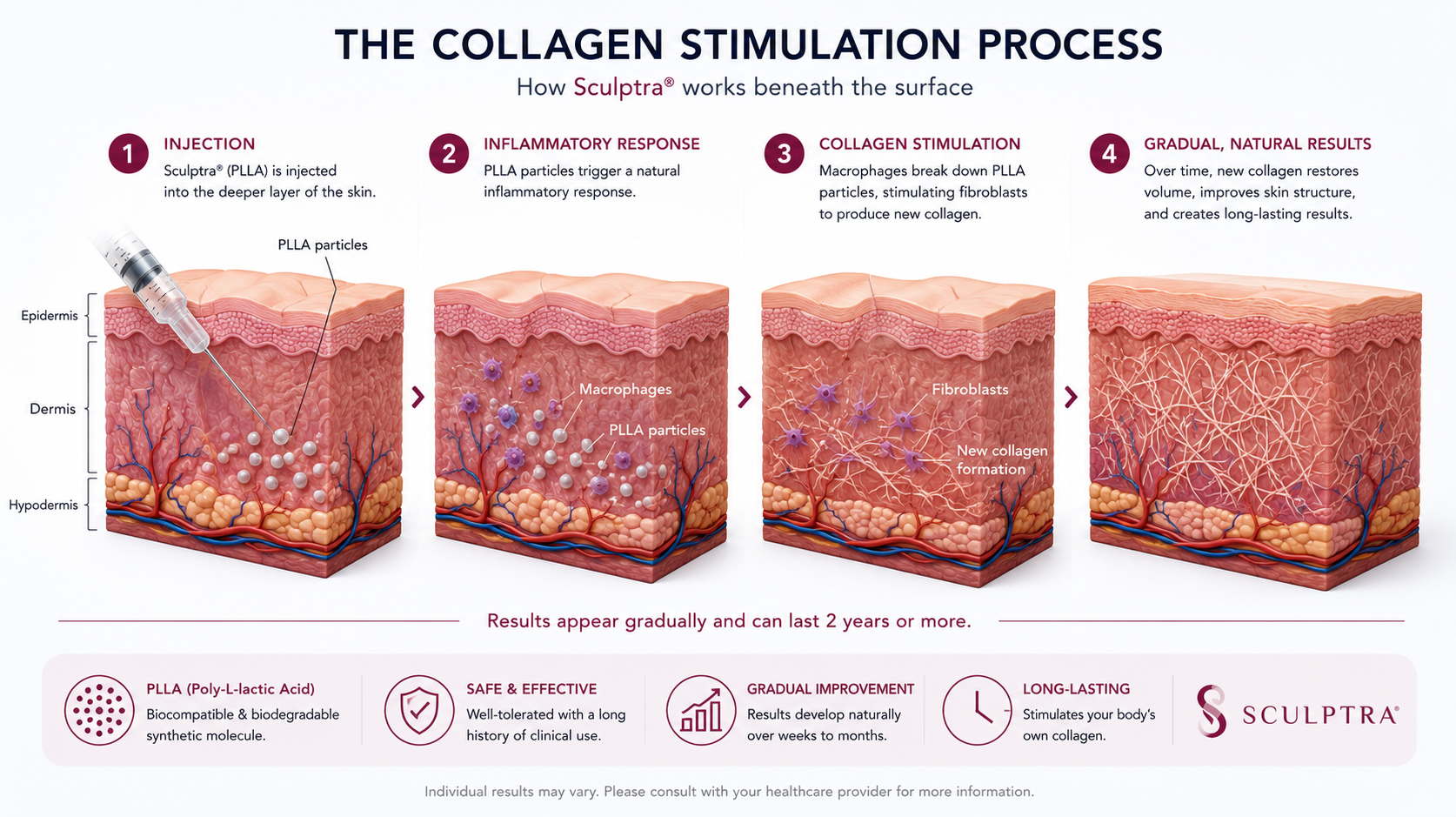 collagen stimulation process