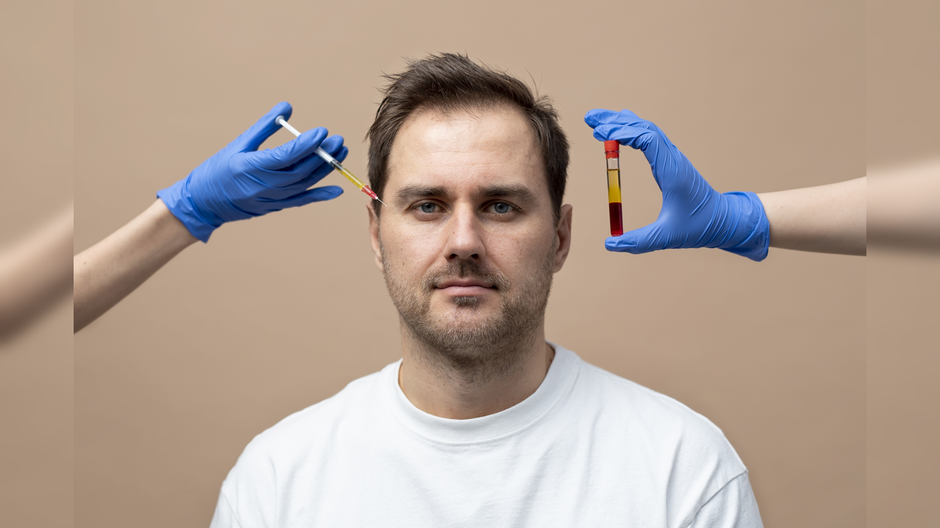 microneedling vs PRP Toronto