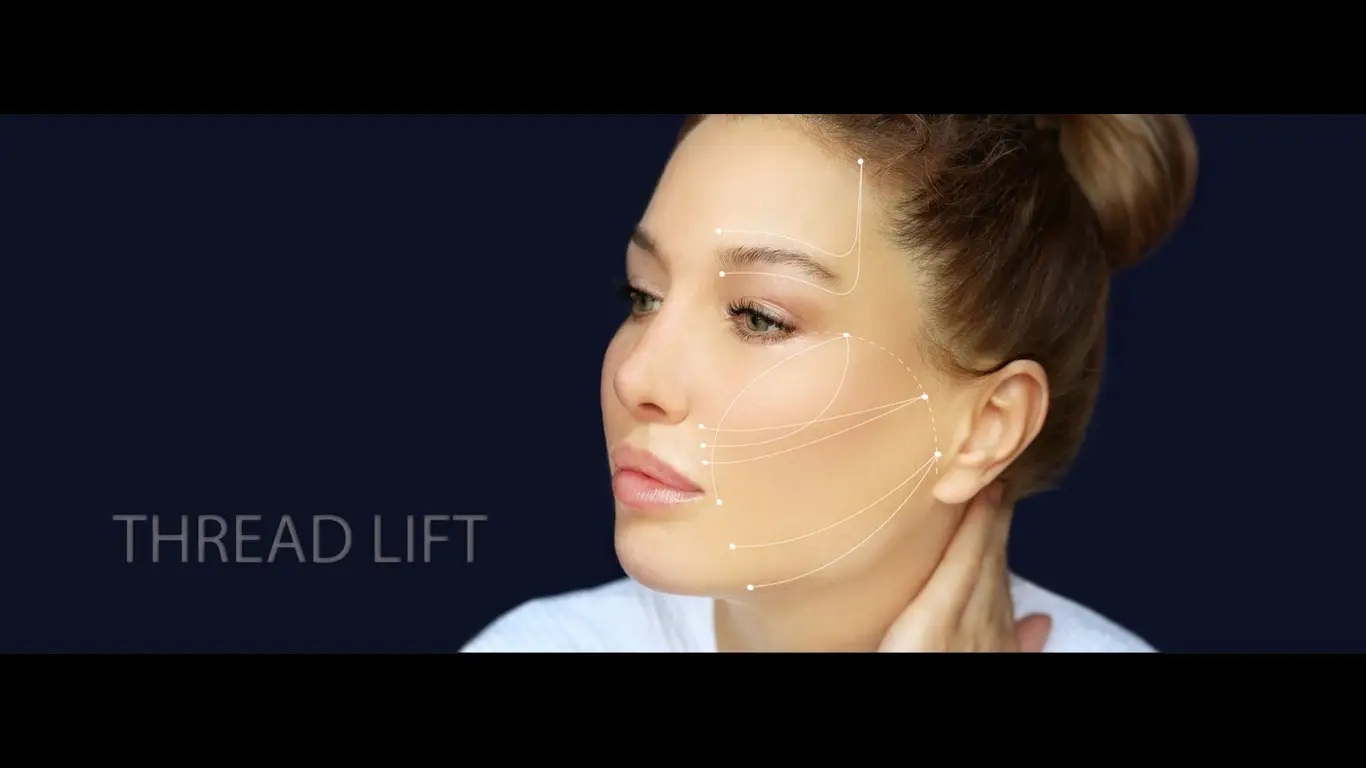 thread lift vs facelift